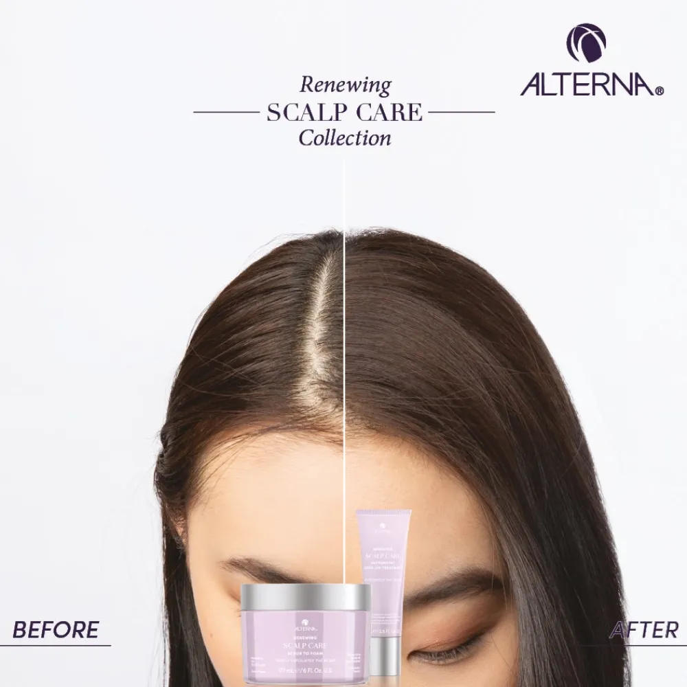 Renewing Scalp Care Peppermint Scalp Treatment 47 ml-Alterna Best
