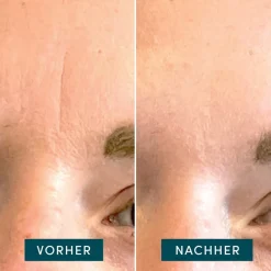 APRICOT Gesicht|Baumwoll-Gesichtspflaster mit Hyaluron 24 Stück