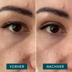 APRICOT Hautverjüngung|Gesicht^Eyelid Lifting Tapes 96 Stück