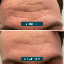 Gesicht Patches mit Aloe Vera-APRICOT Outlet