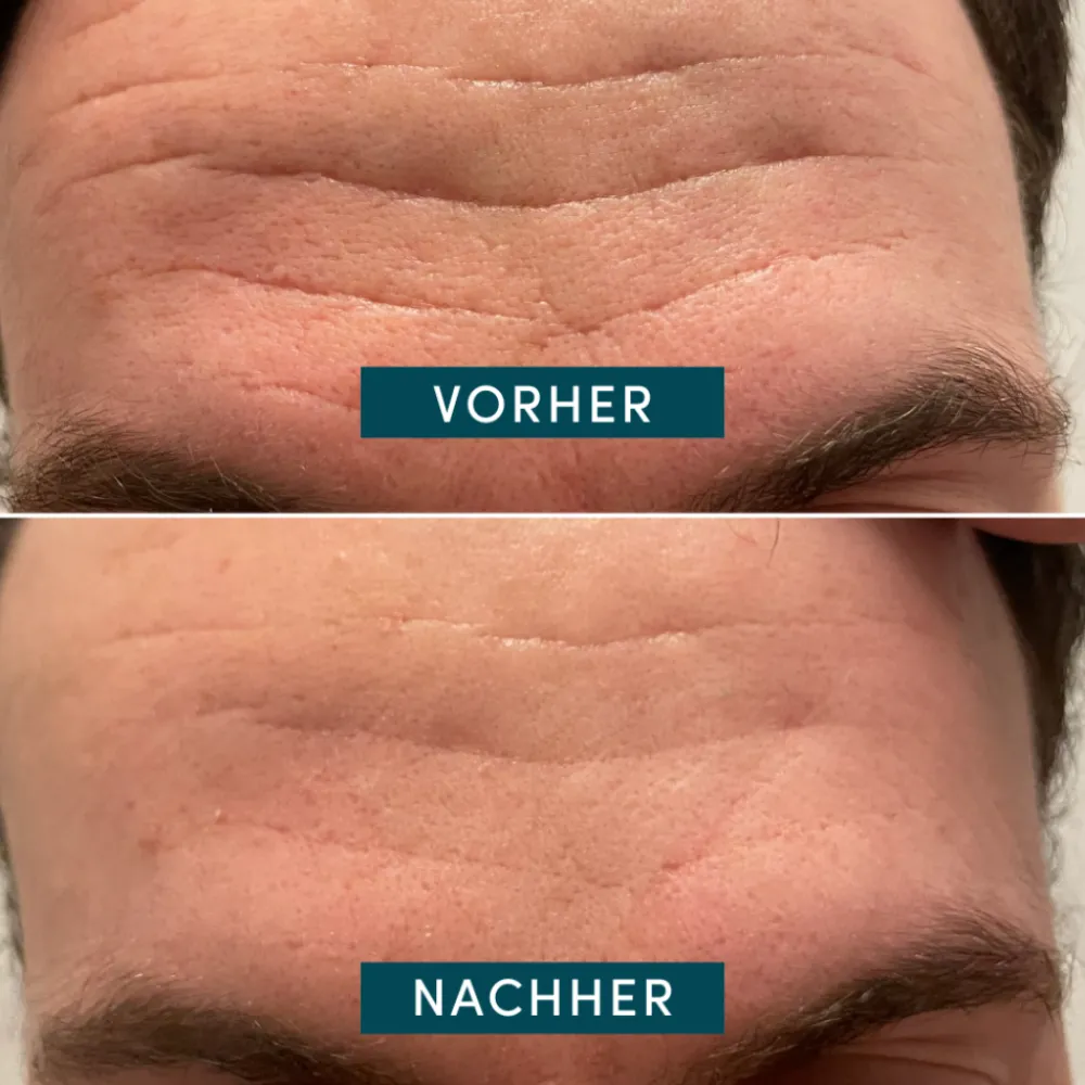 Gesicht Patches mit Aloe Vera-APRICOT Outlet