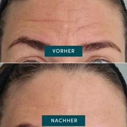 Wiederverwendbares Stirn Pad mit Vitamin C-APRICOT Discount