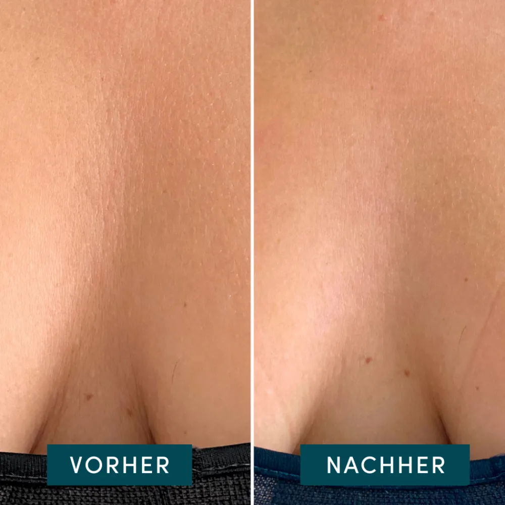 Wiederverwendbares Dekolleté Pad mit Aloe Vera-APRICOT Best