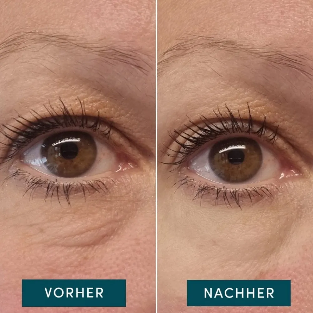 APRICOT Gesicht|Wiederverwendbare Augen-Schläfen Pads mit Hexapeptid-Technologie Limited Edition 2 Stück