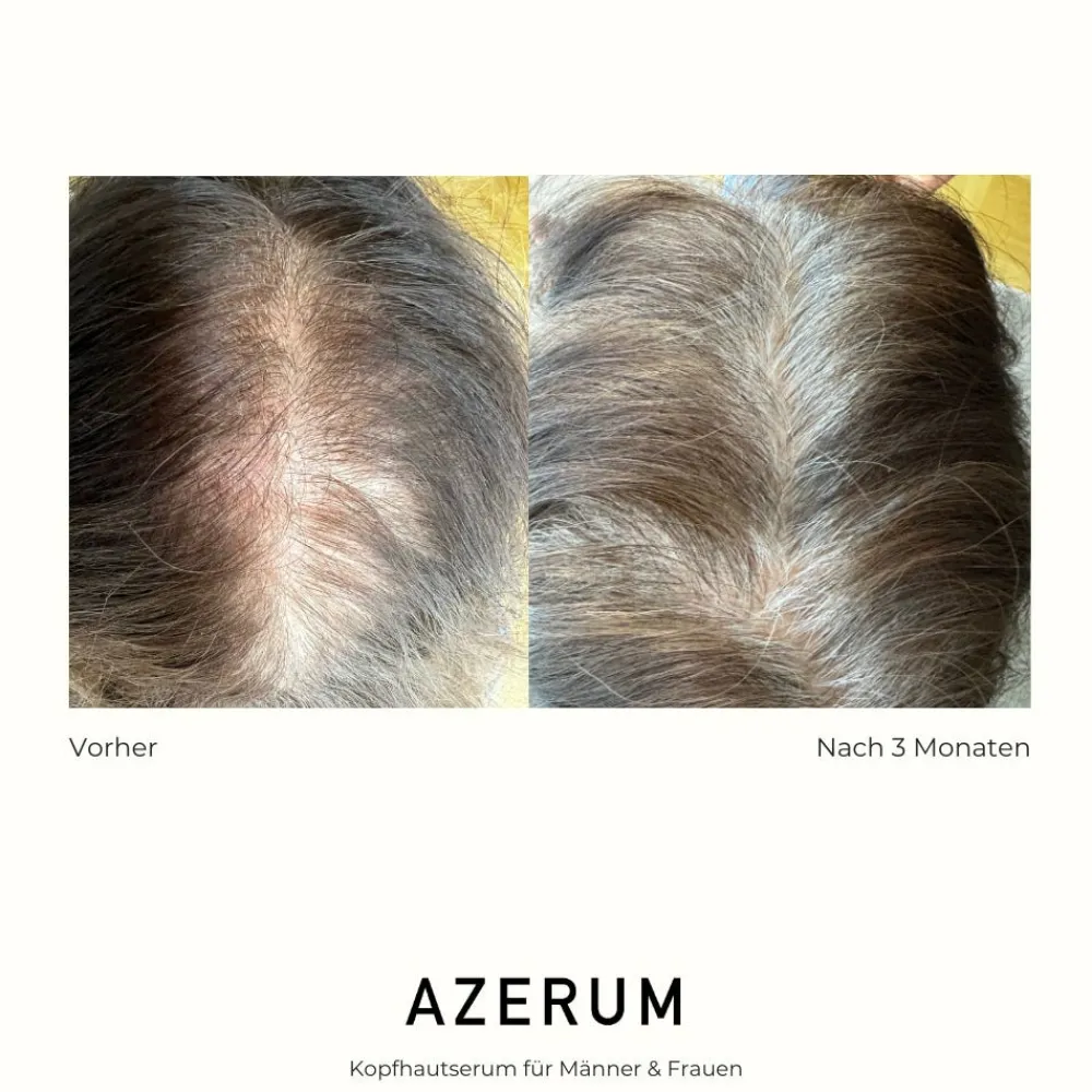 AZERUM Haarausfall|Haarverdichtung^Kopfhautserum 100 ml