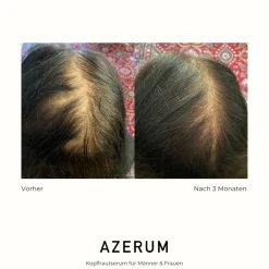 AZERUM Haarausfall|Haarverdichtung^Kopfhautserum 100 ml