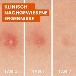 BIORÉ Gesicht|Anti-Pickel Patches 3in1 24 Stück