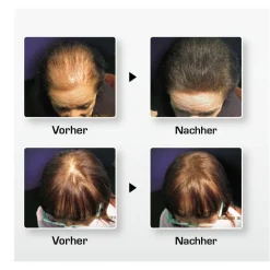 BioThik Kopfhautpflege|Haarverdichtung|Haaraufbau-Faser S8 mittelblond 25 g