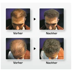 BioThik Kopfhautpflege|Haarverdichtung^Haaraufbau-Faser S9 rotbraun 15 g