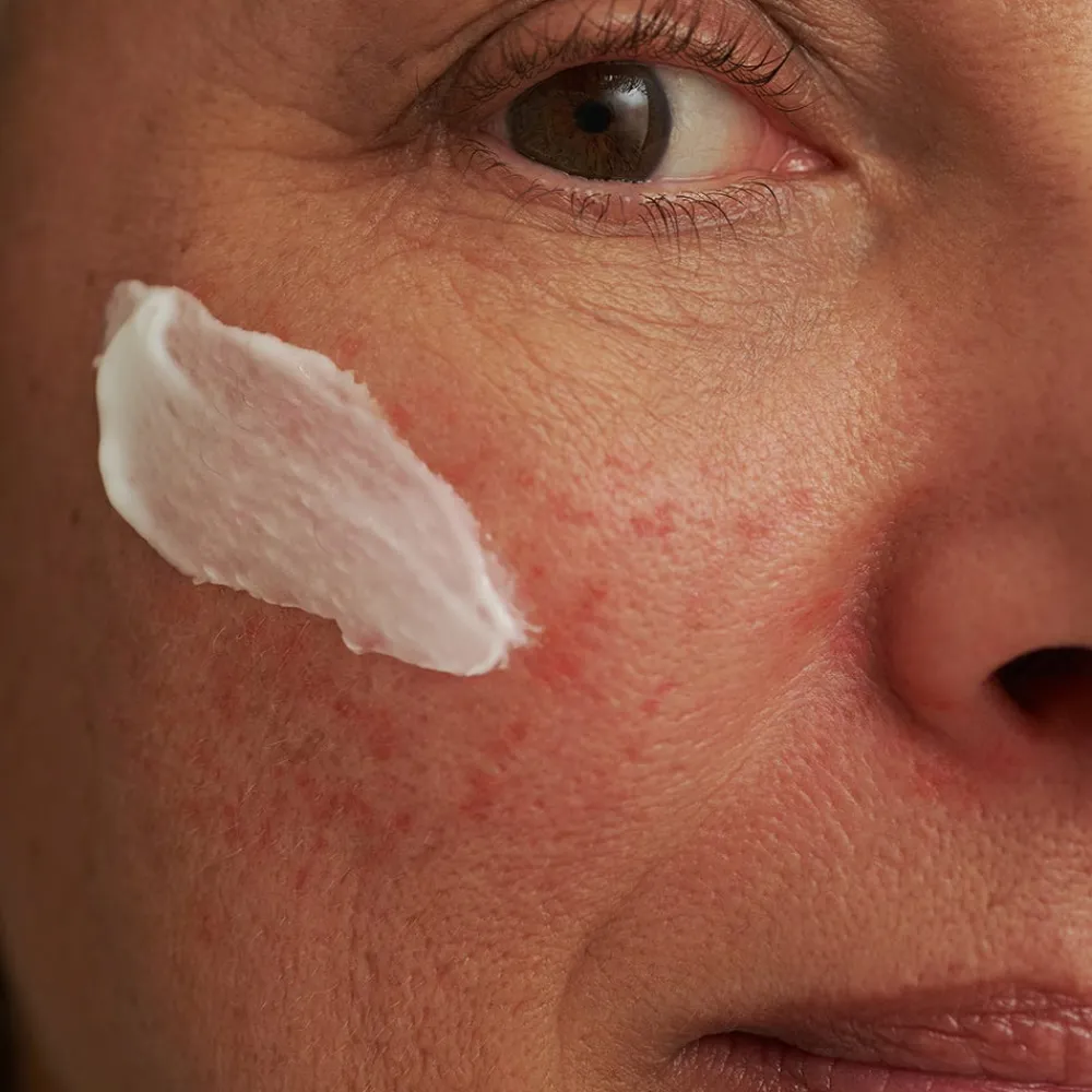 Dado Sens Hagel Nature|Gesicht^SENSACEA Gesichtsemulsion 50 ml