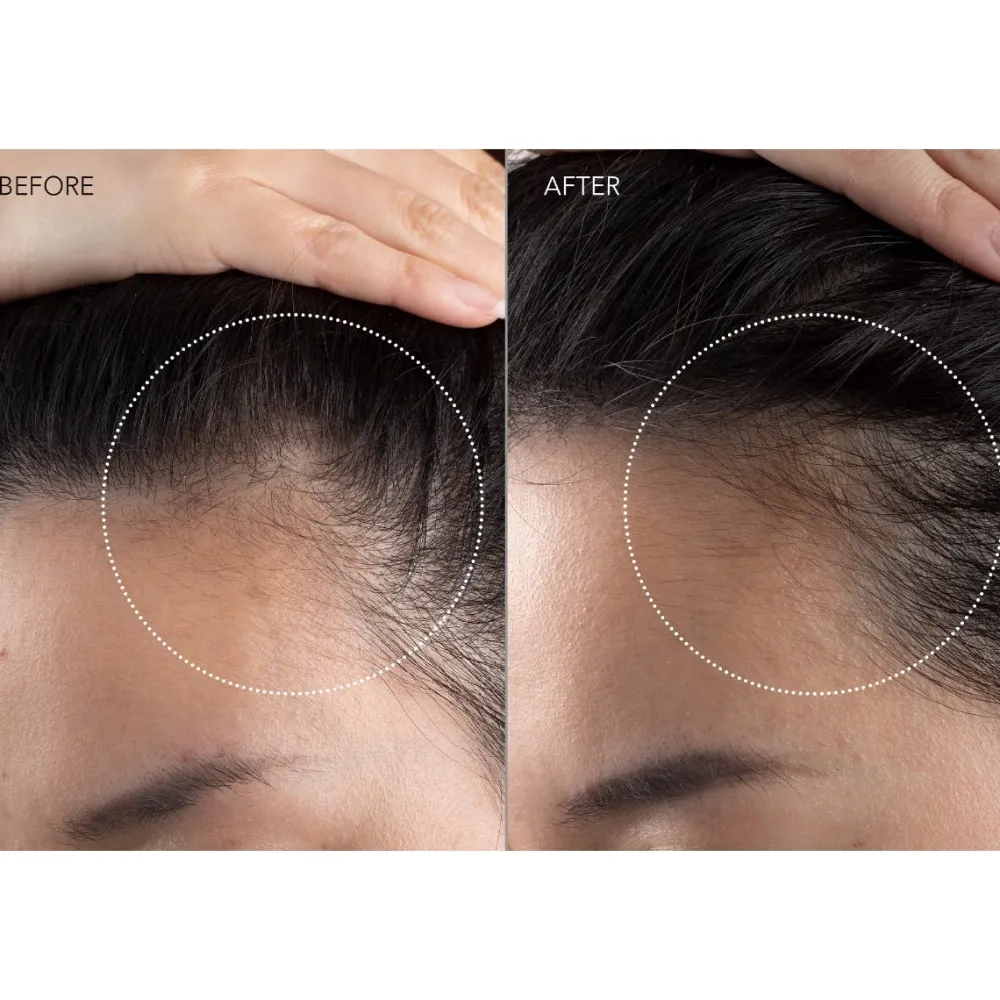 FAQ Swiss Kopfhautpflege|301 LED Hair Strengthening Scalp Massager