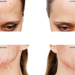 FOREO Sweden Gesicht^ESPADA 2 Fuchsia