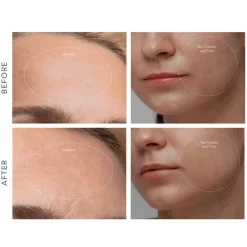 FOREO Sweden Gesicht^KIWI derma