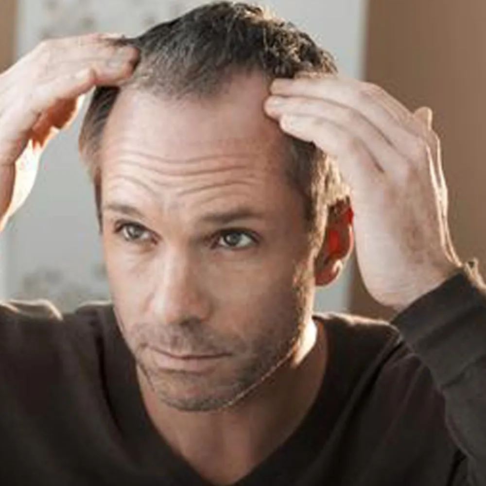 Natucain Haarausfall|Haarausfall & Spezialpflege^Hair Activator 100 ml