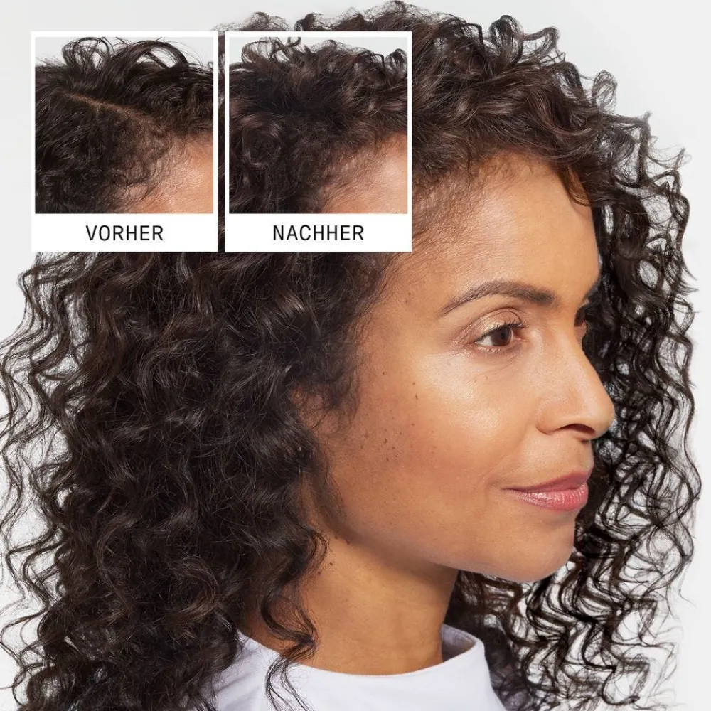 Anti-Hair Loss Shampoo 240 ml-Nioxin Discount