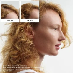 Nioxin Kopfhautpflege|Haarausfall^Scalp + Hair System 1 Treatment 100 ml