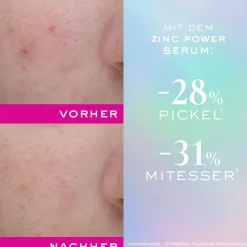 Zinc Power Serum 30 ml-NUXE Online