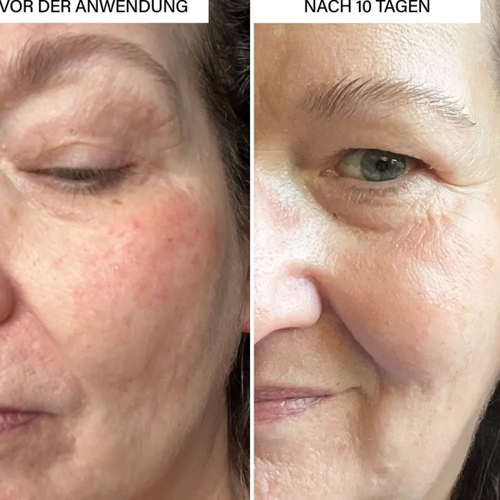 Rosental Organics Gesicht^Brightening Serum 30 ml