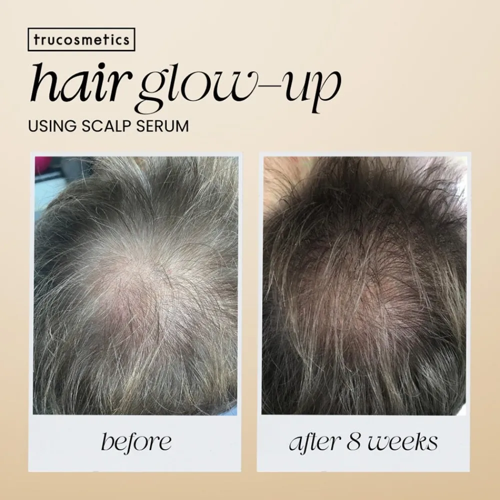 Trucosmetics Hair Growth Serum 50 ml-TRU Cosmetics Discount