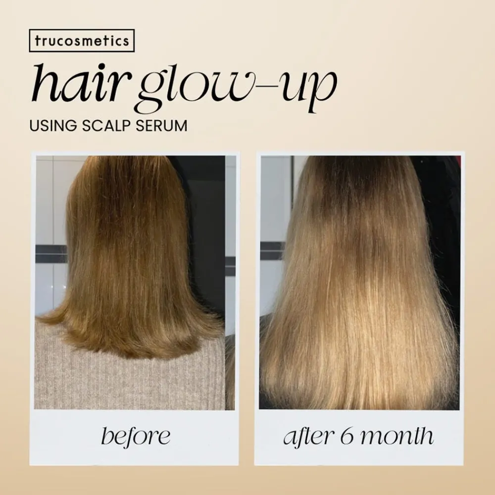 Trucosmetics Hair Growth Serum 50 ml-TRU Cosmetics Discount