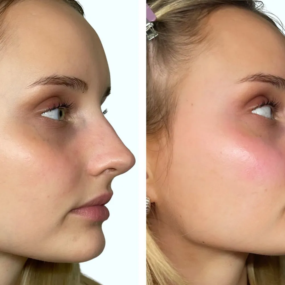 Venicebody Lippen|PH-Activated Blush Stick Lip & Cheek 6,2 g