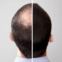 Volume Hair Haarverdichtung^Fix 100 ml