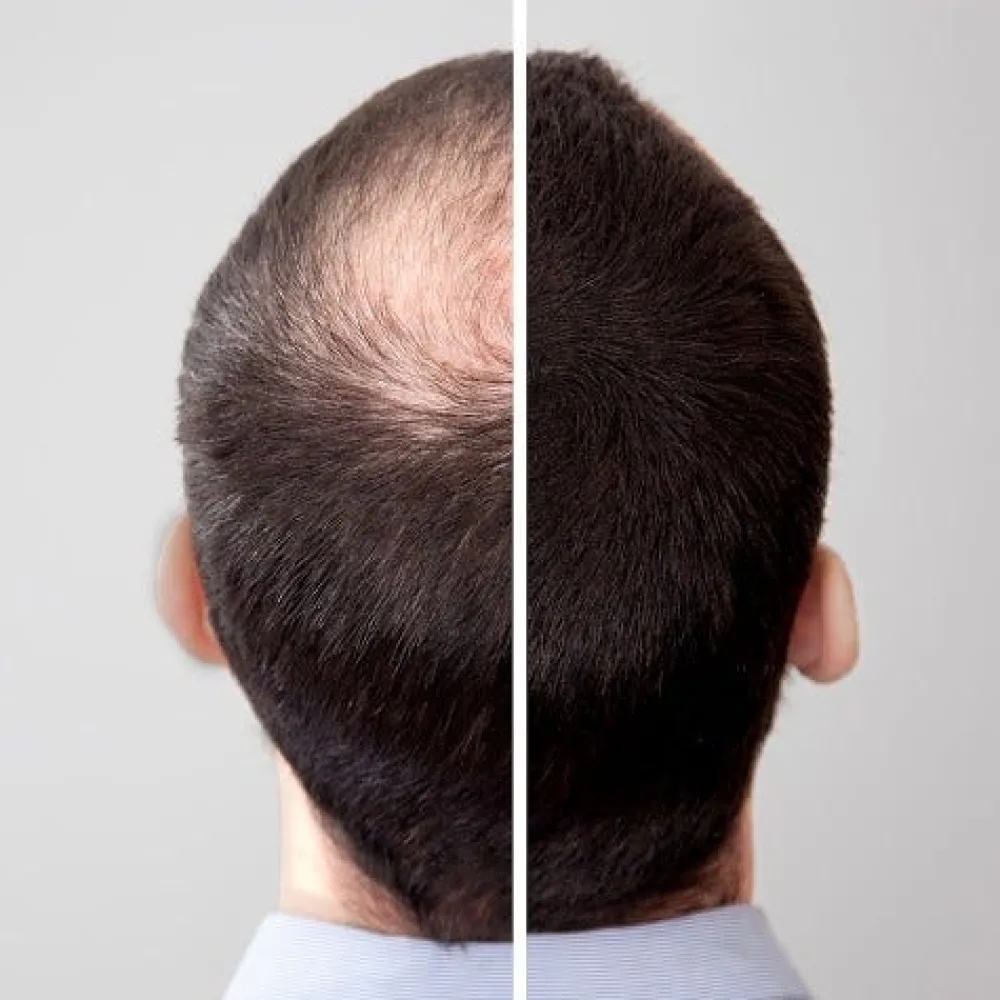 Volume Hair Haarverdichtung^Fix 100 ml